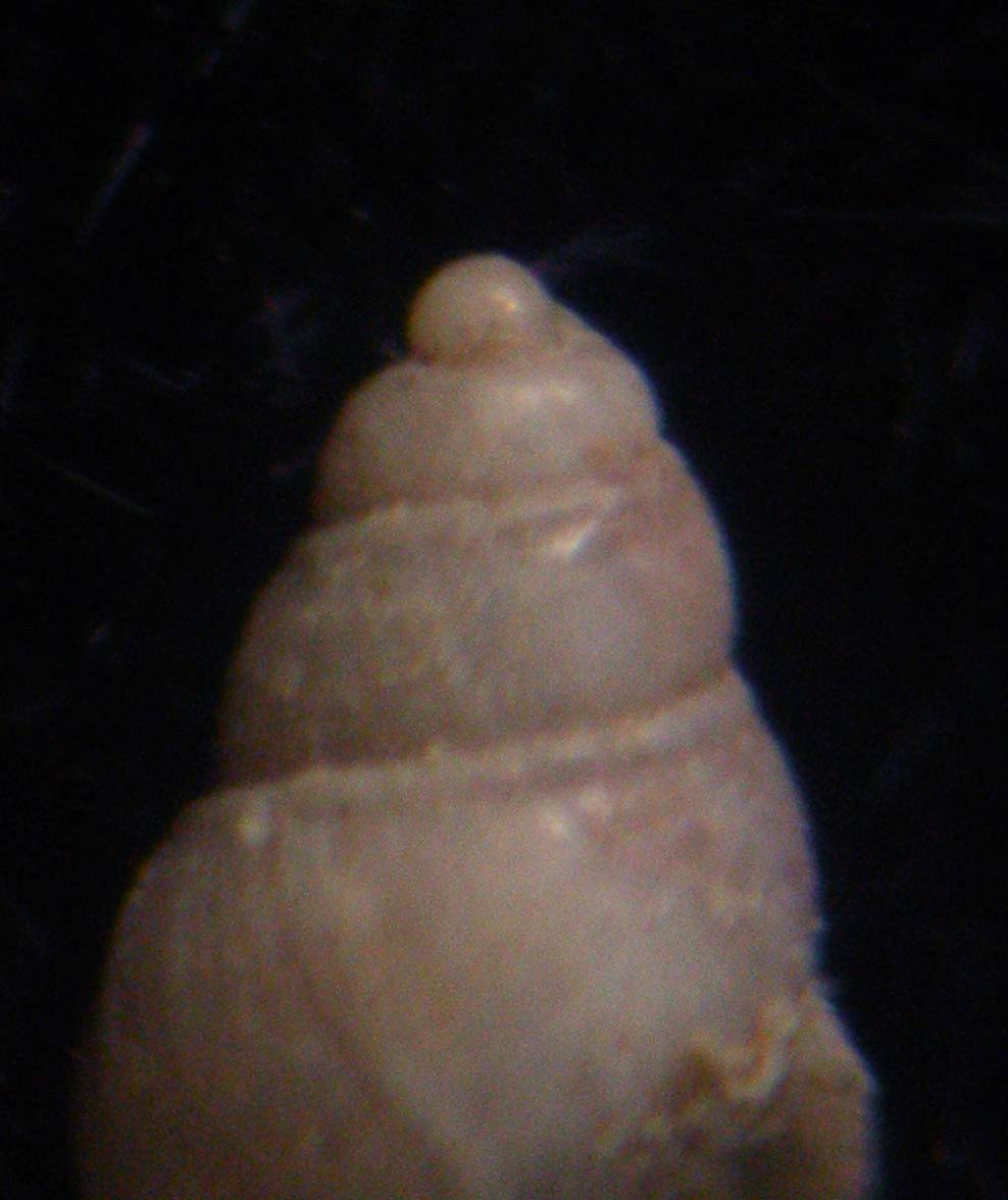 odostomia????????